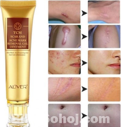 ALIVER TCM SCAR AND ACNE REMOVAL GEL OINTMENT